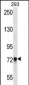 PCDHB5 Antibody (Center)