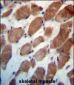 TRIM54 Antibody (N-term)