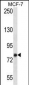 KCTD3 Antibody (C-term)