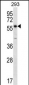 PNPLA1 Antibody (N-term)