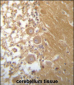 DEGS1 Antibody (N-term)