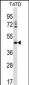 DEGS1 Antibody (N-term)