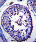 TRIM39 Antibody (Center)