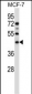 SGMS1 Antibody (N-term)