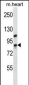 DHX32 Antibody (Center)