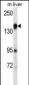 PLXNC1 Antibody (C-term)