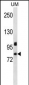 PDZD4 Antibody (N-term)