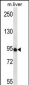 PDZD4 Antibody (N-term)