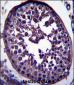 GAGE12H Antibody (N-term)