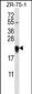 GAGE12H Antibody (N-term)