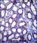 TRIM34 Antibody (N-term)