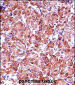 MMP28 Antibody (Center)