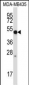 MMP28 Antibody (Center)