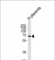 MMP19 Antibody (N-term)