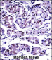 PPP2CB Antibody (C-term)