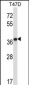 PPP2CB Antibody (C-term)