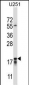 CTAG2 Antibody (Center)