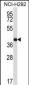 SYT2 Antibody (Center)