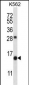 SCGB1D2 Antibody (Center)