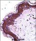 S100A7 Antibody (N-term)