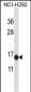 S100A7 Antibody (N-term)