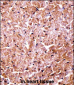 Mouse Camk2d Antibody (Center)