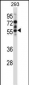 Mouse Camk2d Antibody (Center)