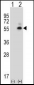 Mouse Camk2d Antibody (Center)