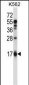 EDN2 Antibody (C-term)