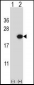 EDN2 Antibody (C-term)