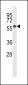 PPM1D Antibody (Center)