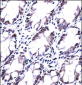 HRASLS5 Antibody (Center)