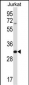 HRASLS5 Antibody (Center)