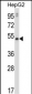 MMP20 Antibody (C-term)