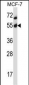 Mouse Akt2 Antibody (N-term)