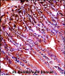 Mouse Abl1 Antibody (Center)