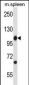 Mouse Abl1 Antibody (Center)