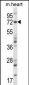 Mouse Map3k7 Antibody (N-term)