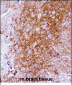 Mouse Ntrk2 Antibody (Center)