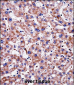 TAGLN2 Antibody (C-term)