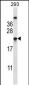 TAGLN2 Antibody (C-term)