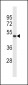 SYT5 Antibody (Center)