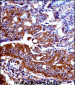 Mouse Npr1 Antibody (N-term)