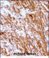 Mouse Pdk2 Antibody (N-term)