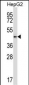 Mouse Pdk2 Antibody (N-term)