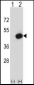 Mouse Pdk2 Antibody (N-term)