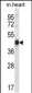 Mouse Pdk2 Antibody (N-term)