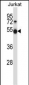 Mouse Pim1 Antibody (C-term)