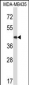 Mouse Map2k5 Antibody (C-term)