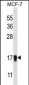 NDUFA13 Antibody (N-term)